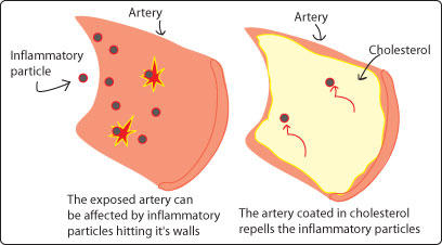 Artery & Cholesterol Illustration